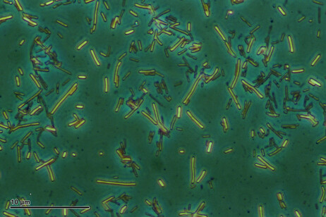 Immagine generica di batteri (fonte: Doc. RNDr. Josef Reischig, CSc., da Wikimedia)