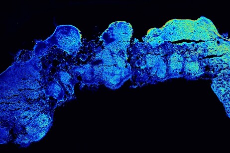 Un organoide allungato della corteccia cerebrale (fonte: Camilla Bosone, IMBA)