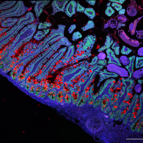 Cellule dell'intestino umano (fonte: Grace Burgin, Noga Rogel &amp; Moshe Biton, Klarman Cell Observatory, Broad Institute)