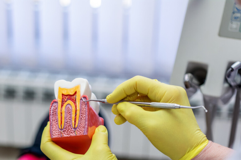 Dentista che spiega l 'aspetto della cavità dentale. Paradontite denti Foto: bluecinema - iStock - RIPRODUZIONE RISERVATA