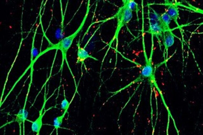 Un archivio di cellule per studiare le basi genetiche dei disturbi psichiatrici (fonte: MiNND group) - RIPRODUZIONE RISERVATA