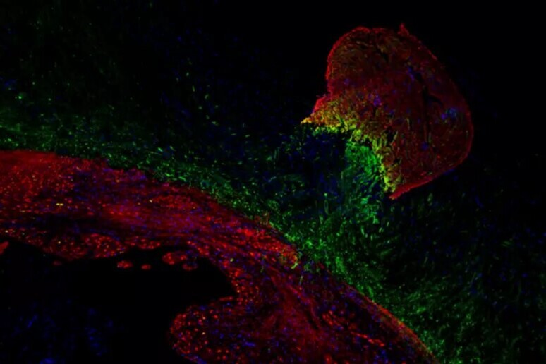 En verde la proteína Hmga1 en el corazón de un pez cebra (arriba dereceha), en rojo las células del músculo cardíaco, en azul el núcleo ceular (Dennis de Bakker e Ward Groutars/ Hubrecht Institute) - TODOS LOS DERECHOS RESERVADOS